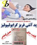 پرفروش ترین پد آنتی فریز کرایولیپولیز، بکو(BECO)