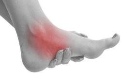 اسکن کف پا در غرب تهران