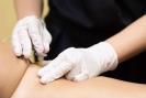 ارائه خدمات روشن‌سازی پوست (ویژه بانوان) در کلینیک کیمیا اکسیر 